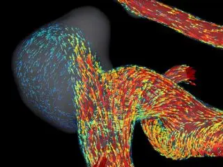 Blood Flow CFD