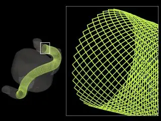 Virtual Stenting